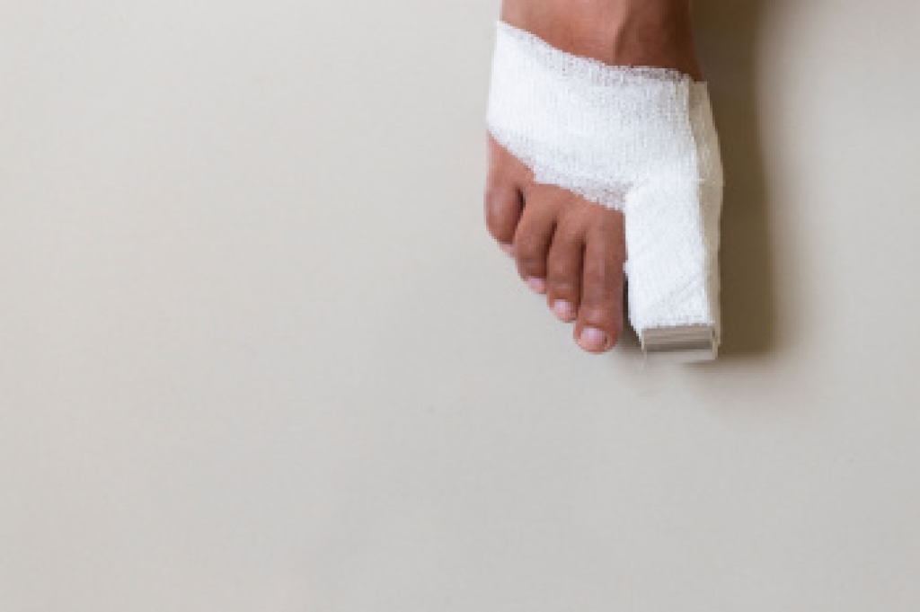 How a Podiatrist Diagnoses and Treats Broken Toes