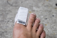 Proper Treatment of Broken Toes