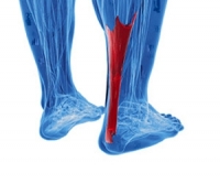 How the Achilles Tendon Can Be Injured